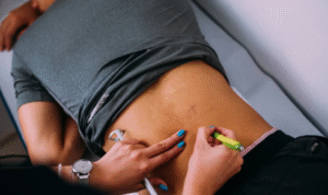 sciatica treatment